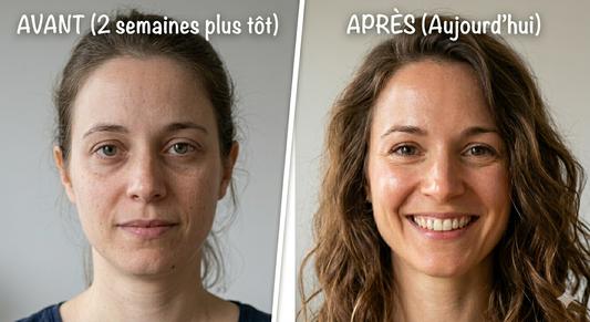 Masque-Led La lumière qui révèle votre éclat naturel
